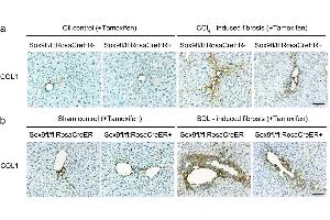 Characterisation of COL1 expression in control and Sox9-null animals following liver fibrosis induction using ABIN135046. (Collagen Type I Antikörper)