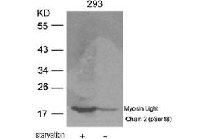 Image no. 2 for anti-Myosin, Light Chain 2, Regulatory, Cardiac, Slow (MYL2) (pSer18) antibody (ABIN319223)