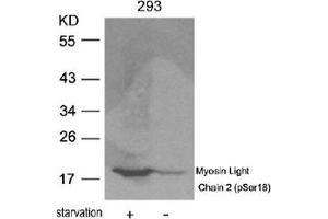 Image no. 2 for anti-Myosin, Light Chain 2, Regulatory, Cardiac, Slow (MYL2) (pSer18) antibody (ABIN319223) (MYL2 Antikörper  (pSer18))