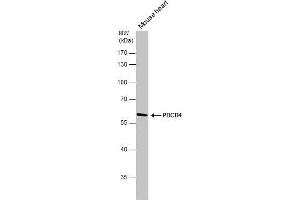 WB Image PDCD4 antibody detects PDCD4 protein by western blot analysis.