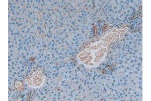 Immunohistochemistry (IHC) image for anti-S100 Calcium Binding Protein A6 (S100A6) (AA 1-89) antibody (ABIN7437005)