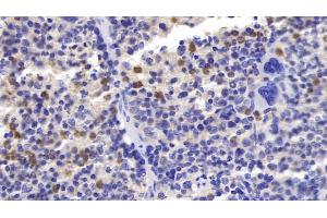 Detection of FceRI in Mouse Spleen Tissue using Polyclonal Antibody to Receptor I For The Fc Region Of Immunoglobulin E (FceRI) (Fc epsilon RI/FCER1A Antikörper  (AA 24-204))