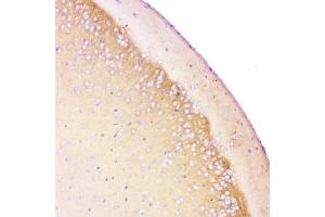 Immunohistochemistry (IHC) image for anti-Amyloid beta (A4) Precursor Protein (APP) (C-Term) antibody (ABIN3029934)