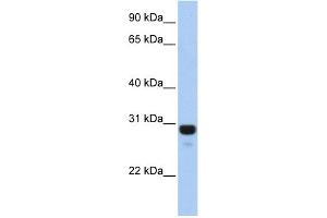 WB Suggested Anti-AMN1 Antibody Titration: 0. (AMN1 Antikörper  (N-Term))