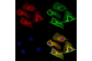 ABIN6265899 and ABIN6273182 staining Hela cells by IF/ICC.