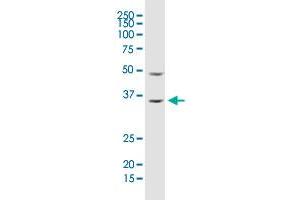 ARHGDIA monoclonal antibody (M02), clone 1G5-2F3. (ARHGDIA Antikörper  (AA 1-204))