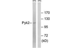 Western blot analysis of extracts from NIH-3T3 cells, using PYK2 (Ab-579) Antibody. (PTK2B Antikörper  (AA 545-594))