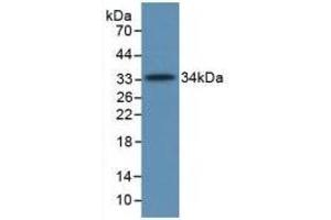 Detection of Recombinant C5a, Human using Monoclonal Antibody to Complement Component 5a (C5a) (C5A Antikörper  (AA 678-751))