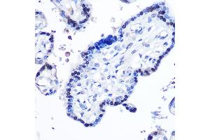 Immunohistochemistry (IHC) image for anti-Signal Transducer and Activator of Transcription 5B (STAT5B) (AA 1-100) antibody (ABIN6148579)