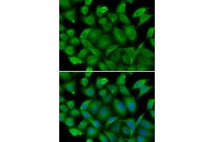 Immunofluorescence analysis of HeLa cell using DEFA1 antibody. (alpha Defensin 1 Antikörper)