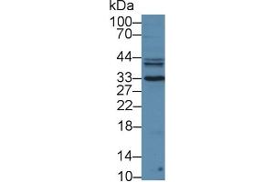 Detection of PSA in Mouse Liver lysate using Polyclonal Antibody to Prostate Specific Antigen (PSA) (Prostate Specific Antigen Antikörper  (AA 39-261))