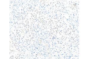 Immunohistochemistry (IHC) image for anti-Zinc Finger CCCH-Type Containing 4 (ZC3H4) (AA 1050-1100) antibody (ABIN7795760)