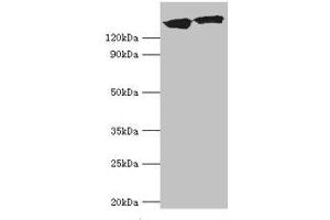 Western blot All lanes: DCTN1 antibody at 20 μg/mL Lane 1: Mouse brain tissue Lane 2: Jurkat whole cell lysate Secondary Goat polyclonal to rabbit IgG at 1/10000 dilution Predicted band size: 142, 128, 137, 139, 127, 141 kDa Observed band size: 142 kDa (Dynactin 1 Antikörper  (AA 1084-1278))