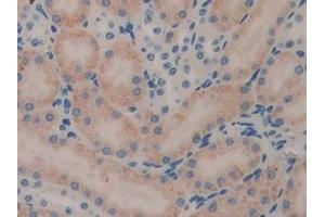 Immunohistochemistry (IHC) image for anti-serpin Peptidase Inhibitor, Clade B (Ovalbumin), Member 1 (SERPINB1) (AA 184-368) antibody (ABIN7435499)