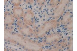 Detection of LEI in Mouse Kidney Tissue using Polyclonal Antibody to Leukocyte Elastase Inhibitor (LEI) (SERPINB1 Antikörper  (AA 184-368))
