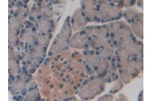 IHC-P analysis of Rat Pancreas Tissue, with DAB staining. (SLIT1 Antikörper  (AA 3-112))