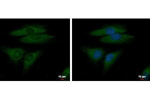 ICC/IF Image FGFR-5 antibody detects FGFR-5 protein at cytoplasm by immunofluorescent analysis.