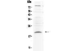Western blot analysis of Relaxin 1 using anti-Relaxin 1 antibody . (Relaxin 1 Antikörper)