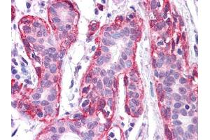 Immunohistochemical analysis of paraffin-embedded human Breast tissues using FRK mouse mAb. (FRK Antikörper  (AA 2-300))