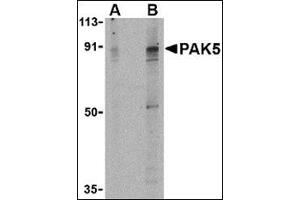 Western blot analysis of PAK5 in T24 lysate with this product at (A) 2 and (B) 4 μg/ml. (PAK7 Antikörper  (Center))