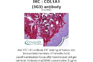 Image no. 1 for anti-Collagen, Type I, alpha 1 (COL1A1) (AA 1021-1108) antibody (ABIN1723789) (COL1A1 Antikörper  (AA 1021-1108))