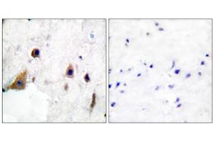 Immunohistochemical analysis of paraffin-embedded human brain tissue, using DARPP-32 (phospho-Thr75) antibody. (DARPP32 Antikörper  (pThr75))