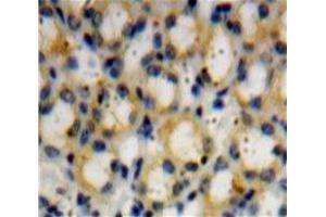 Immunohistochemistry (IHC) image for anti-ADAM Metallopeptidase with Thrombospondin Type 1 Motif, 1 (ADAMTS1) (AA 258-467) antibody (ABIN1857895)