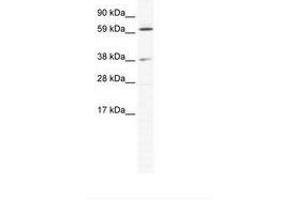 Image no. 1 for anti-ALX Homeobox 3 (ALX3) (N-Term) antibody (ABIN202290) (ALX3 Antikörper  (N-Term))