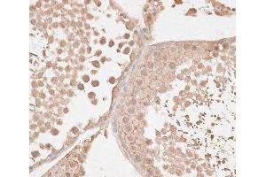 Immunohistochemistry of paraffin-embedded Rat testis using VEGF Receptor 2 Polyclonal Antibody at dilution of 1:100 (40x lens). (VEGFR2/CD309 Antikörper)