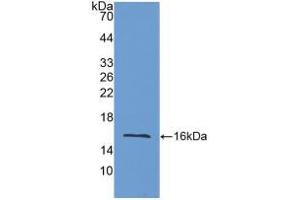 Western blot analysis of recombinant Mouse LOXL2. (LOXL2 Antikörper  (AA 53-160))