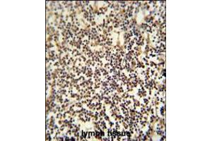 C12orf48 antibody immunohistochemistry analysis in formalin fixed and paraffin embedded human lymph tissue followed by peroxidase conjugation of the secondary antibody and DAB staining. (PARPBP Antikörper  (C-Term))