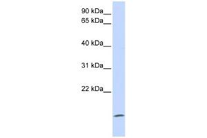 WB Suggested Anti-ZG16 Antibody Titration: 0. (ZG16 Antikörper  (Middle Region))