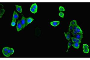 Immunofluorescent analysis of PC-3 cells cells using ABIN7175887 at dilution of 1:100 and Alexa Fluor 488-congugated AffiniPure Goat Anti-Rabbit IgG(H+L) (RPGR Antikörper  (AA 1-180))