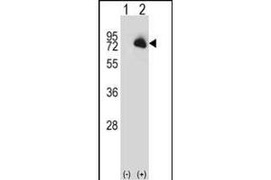 Western blot analysis of BTK (arrow) using rabbit polyclonal BTK Antibody (N-term) (ABIN657469 and ABIN2846497). (BTK Antikörper  (N-Term))