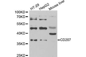 Western blot analysis of extracts of various cell lines, using CD207 antibody (ABIN5973934) at 1/1000 dilution. (CD207 Antikörper)