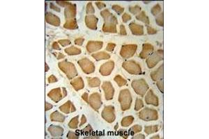 DHRS7 Antibody (N-term) (ABIN650968 and ABIN2840014) immunohistochemistry analysis in formalin fixed and paraffin embedded human skeletal muscle followed by peroxidase conjugation of the secondary antibody and DAB staining. (DHRS7 Antikörper  (N-Term))