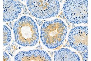ABIN6266014 and ABIN6273185 at 1/100 staining Mouse testis tissue by IHC-P. (WBP2NL Antikörper  (Internal Region))
