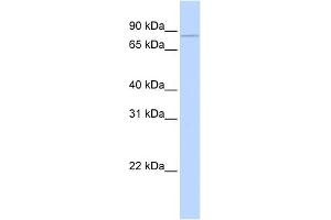 WB Suggested Anti-CPEB3 Antibody Titration: 0. (CPEB3 Antikörper  (Middle Region))