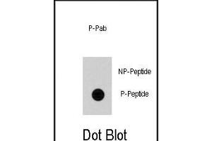 Dot blot analysis of anti-Cdc25A Phospho-specific Pab (ABIN389906 and ABIN2839740) on nitrocellulose membrane. (CDC25A Antikörper  (pSer79))