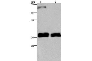 Western Blot analysis of 231 and A172 cell using FETUB Polyclonal Antibody at dilution of 1:700 (FETUB Antikörper)