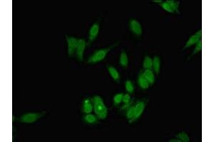 Immunofluorescent analysis of Hela cells using ABIN7154810 at dilution of 1:100 and Alexa Fluor 488-congugated AffiniPure Goat Anti-Rabbit IgG(H+L) (DKC1 Antikörper  (AA 94-170))