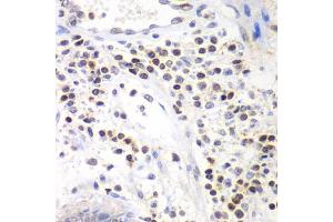 Immunohistochemistry of paraffin-embedded human colon using SMARCA4 antibody (ABIN6290438) at dilution of 1:100 (40x lens). (SMARCA4 Antikörper)
