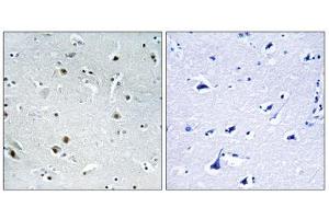 Immunohistochemistry analysis of paraffin-embedded human brain tissue using DDX24 antibody. (DDX24 Antikörper  (N-Term))