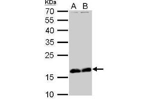 Stathmin 1 Antikörper  (C-Term)