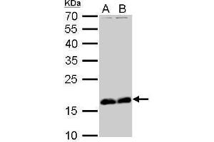 WB Image Stathmin 1 antibody detects STMN1 protein by Western blot analysis. (Stathmin 1 Antikörper  (C-Term))