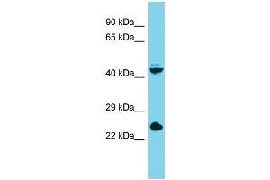 Host: Rabbit Target Name: Stra8 Sample Type: Mouse Liver lysates Antibody Dilution: 1. (STRA8 Antikörper  (C-Term))