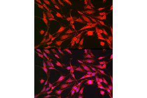 Immunofluorescence (IF) image for anti-Ribosomal Protein S6 Kinase, 70kDa, Polypeptide 1 (RPS6KB1) (AA 361-525) antibody (ABIN7270029)