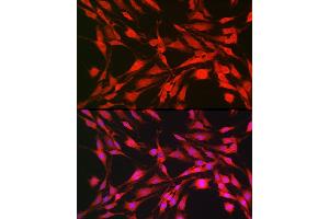 Immunofluorescence analysis of C6 cells using p70 S6 Kinase 1 Rabbit pAb (ABIN7270029) at dilution of 1:100 (40x lens). (RPS6KB1 Antikörper  (AA 361-525))