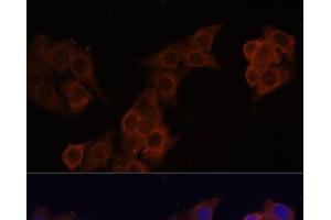 Immunofluorescence analysis of HeLa cells using DCN Polyclonal Antibody at dilution of 1:100 (40x lens). (Decorin Antikörper)