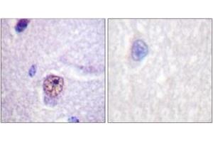 Immunohistochemistry analysis of paraffin-embedded human brain tissue, using SF1 (Ab-82) Antibody. (Splicing Factor 1 Antikörper  (AA 48-97))